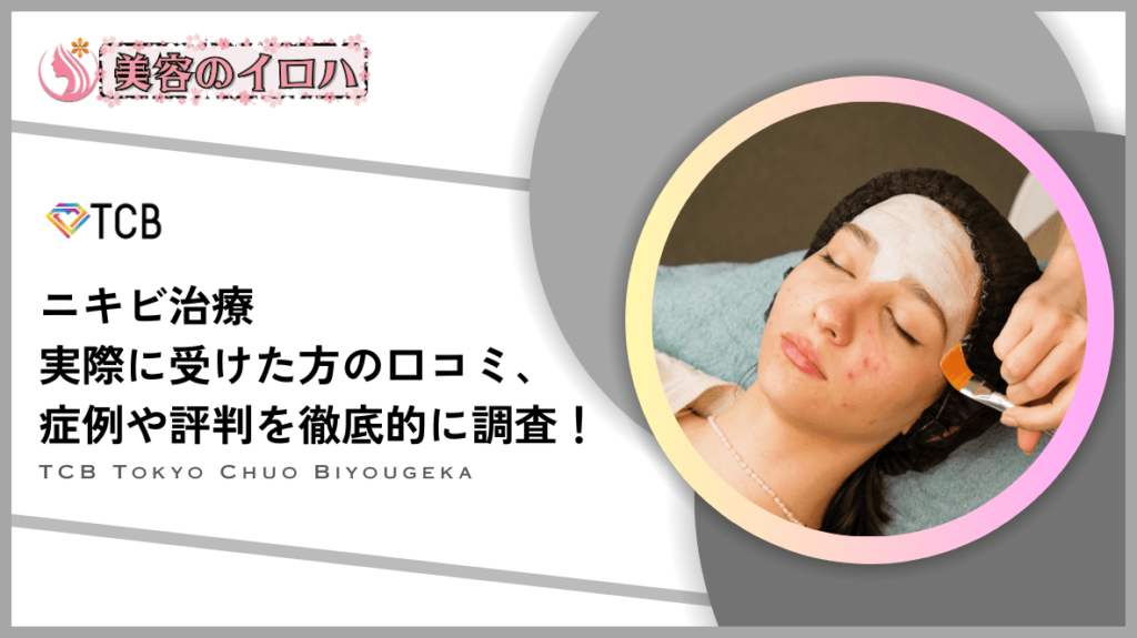 【口コミは？】TCB東京中央美容外科のニキビ治療は安いけど効果ない？実際の評判や症例を調査