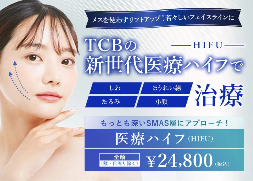 TCB東京中央美容外科のソノクイーンのバナー