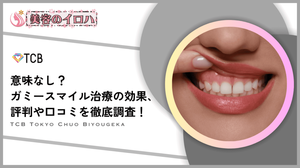 【口コミ評判】TCB東京中央美容外科のガミースマイル治療は効果ある？ボトックスの持ちやバレないか調査